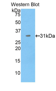 Polyclonal Antibody to Endoplasmic Reticulum Resident Protein 57 (ERp57)