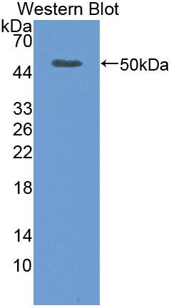 Polyclonal Antibody to Tumor Necrosis Factor Receptor Superfamily, Member 1B (TNFRSF1B)