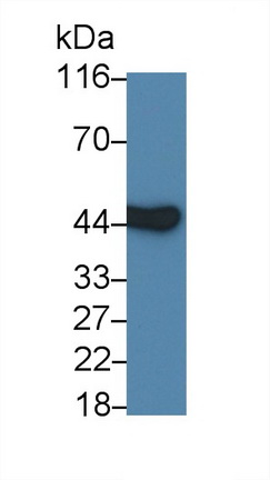 Polyclonal Antibody to Interleukin 3 Receptor Alpha (IL3Ra)