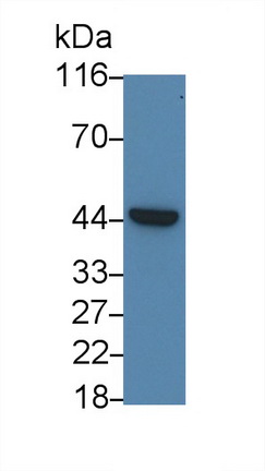 Polyclonal Antibody to Interleukin 3 Receptor Alpha (IL3Ra)