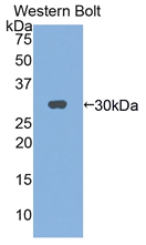 Polyclonal Antibody to Interleukin 2 Receptor Gamma (IL2Rg)