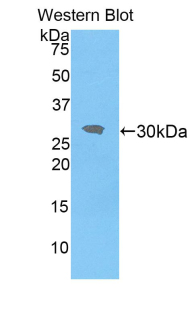 Polyclonal Antibody to Interleukin 1 Receptor Associated Kinase 2 (IRAK2)