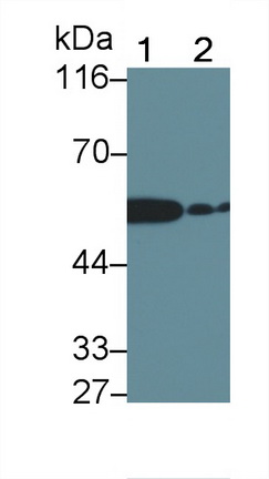 Polyclonal Antibody to Interleukin 1 Receptor Associated Kinase 2 (IRAK2)