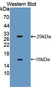 Polyclonal Antibody to Neuronal Apoptosis Inhibitory Protein (NAIP)