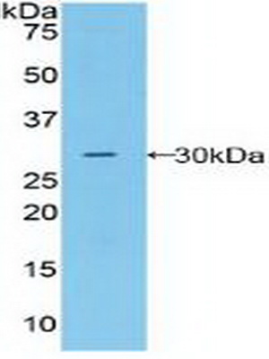 Polyclonal Antibody to Macrophage Stimulating 1 Receptor (MST1R)