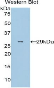 Polyclonal Antibody to Cluster Of Differentiation 36 (CD36)