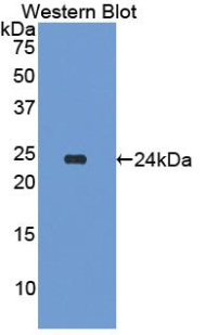 Polyclonal Antibody to Serum Amyloid P Component (SAP)