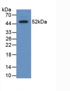 Polyclonal Antibody to Serum Amyloid P Component (SAP)