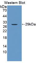 Polyclonal Antibody to Serum Amyloid P Component (SAP)