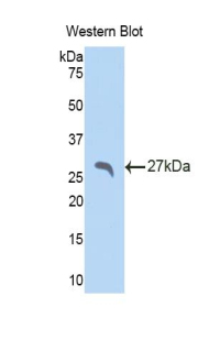 Polyclonal Antibody to Serum Amyloid P Component (SAP)