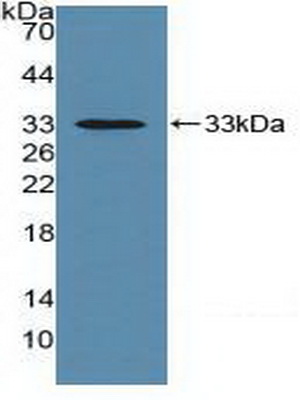 Polyclonal Antibody to Cluster Of Differentiation 147 (CD147)