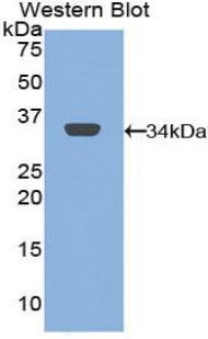 Polyclonal Antibody to Mannose Receptor C Type 1 (MRC1)