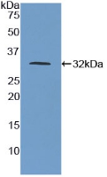 Polyclonal Antibody to Poliovirus Receptor (PVR)