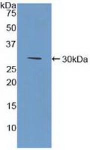 Polyclonal Antibody to Bone Marrow Stromal Cell Antigen 1 (BST1)