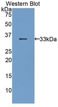 Polyclonal Antibody to Bone Marrow Stromal Cell Antigen 1 (BST1)