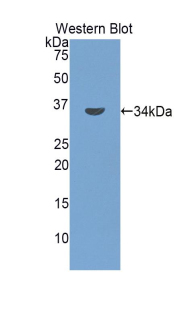 Polyclonal Antibody to Bone Marrow Stromal Cell Antigen 1 (BST1)