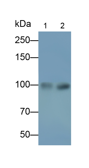 Polyclonal Antibody to A Disintegrin And Metalloprotease 17 (ADAM17)