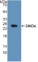 Polyclonal Antibody to Large Multifunctional Peptidase 7 (LMP7)