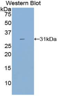 Polyclonal Antibody to Cytochrome P450 Family 21 Subfamily A Member 2 (CYP21A2)