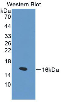 Polyclonal Antibody to Fatty Acid Binding Protein 1 (FABP1)