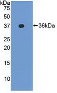 Polyclonal Antibody to Lymphocyte Function Associated Antigen 1 Alpha (CD11a)