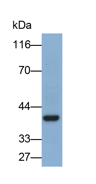 Polyclonal Antibody to Cluster Of Differentiation 64 (CD64)