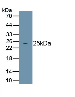 Polyclonal Antibody to Receptor I For The Fc Region Of Immunoglobulin E (FceRI)