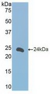 Polyclonal Antibody to Cluster Of Differentiation 23 (CD23)