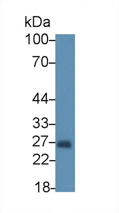 Polyclonal Antibody to Monocyte To Macrophage Differentiation Associated Protein (MMA)