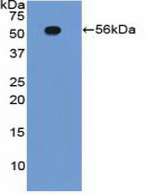 Polyclonal Antibody to Integrin Beta 2 (CD18)