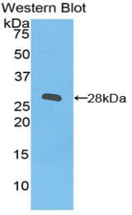 Polyclonal Antibody to Integrin Beta 2 (CD18)