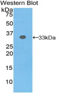 Polyclonal Antibody to Integrin Beta 2 (CD18)