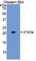 Polyclonal Antibody to Caspase 1 (CASP1)