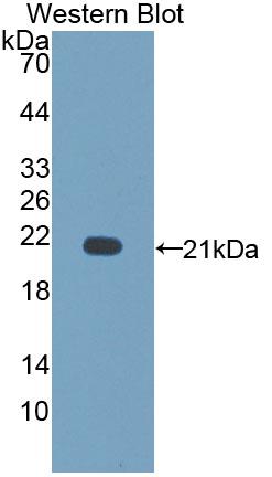 Polyclonal Antibody to Cluster Of Differentiation 164 (C<b>D164</b>)
