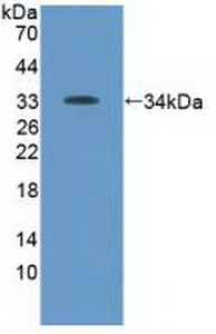 Polyclonal Antibody to Tyrosine Kinase 2 (Tyk2)