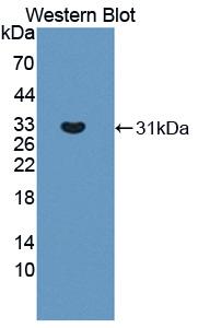 Polyclonal Antibody to Tyrosine Kinase 2 (Tyk2)