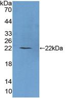 Polyclonal Antibody to Phospholipase C Beta 1 (PLCB1)