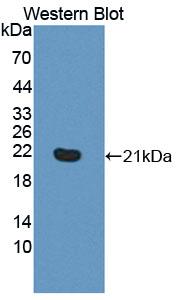 Polyclonal Antibody to Phospholipase C Beta 3, Phosphoinositide Specific (PLCb3)