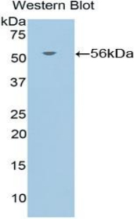 Polyclonal Antibody to Glucocorticoid Receptor (GR)