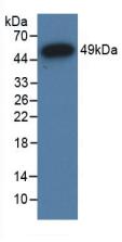 Polyclonal Antibody to Glucocorticoid Receptor (GR)