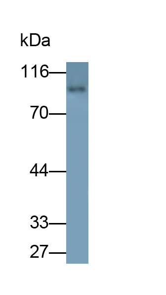 Polyclonal Antibody to Glucocorticoid Receptor (GR)