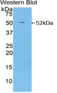 Polyclonal Antibody to Glucocorticoid Receptor (GR)