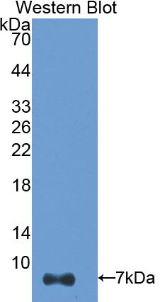 Polyclonal Antibody to Thymosin Beta 4 (TMSB4X)