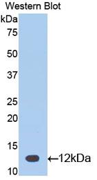 Polyclonal Antibody to Chorionic Gonadotropin Alpha Polypeptide (CGa)