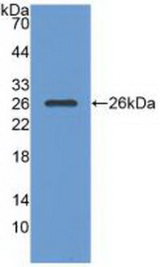 Polyclonal Antibody to Ras GTPase Activating Protein 1 (RASA1)