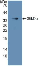 Polyclonal Antibody to GDP Dissociation Inhibitor 1 (GDI1)