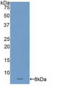 Polyclonal Antibody to C4 Binding Protein Alpha (C4BPa)