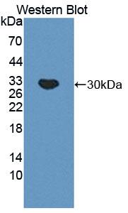 Polyclonal Antibody to C4 Binding Protein Alpha (C4BPa)