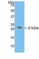 Polyclonal Antibody to Surfactant Protein B (SP-B)