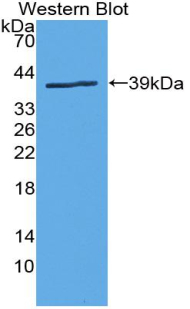 Polyclonal Antibody to Dopamine Transporter (DAT)